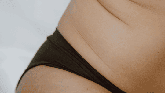 Your Body After Babies... Even If the Baby Is 17 Now