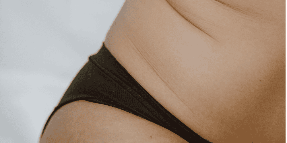 Your Body After Babies... Even If the Baby Is 17 Now